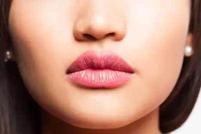 Rellenos de labios Lip Fillers