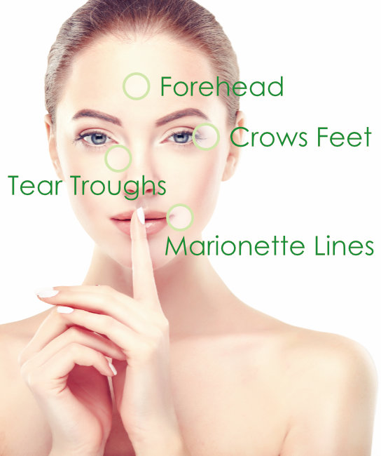 Soft Dermal Fillers Soft Dermal Fillers